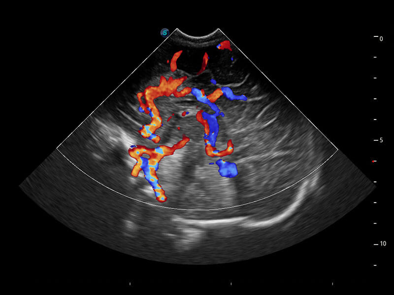 Neonatologia