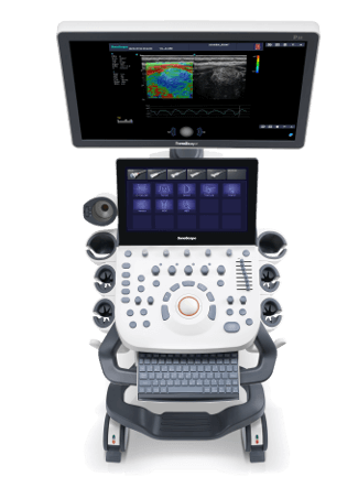 Ultrasonograf SonoScape P20