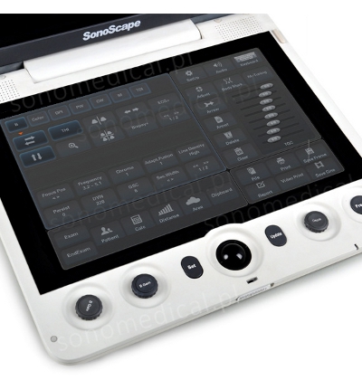 SonoScape S9 pulpit dotykowy